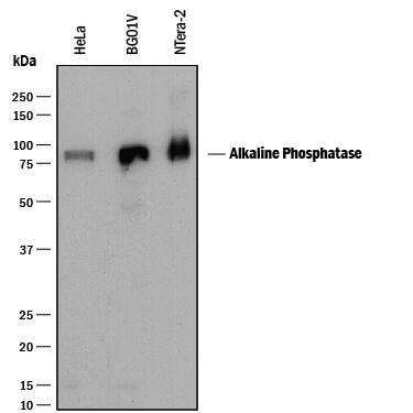 Detection of Human Alkaline Phosphatase/ALPL antibody by Western Blot.