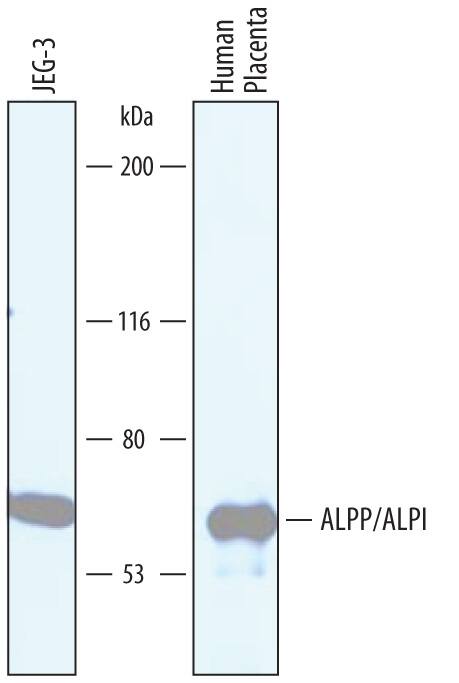 Detection of Human Alkaline Phosphatase/ALPP/ALPI antibody by Western Blot.