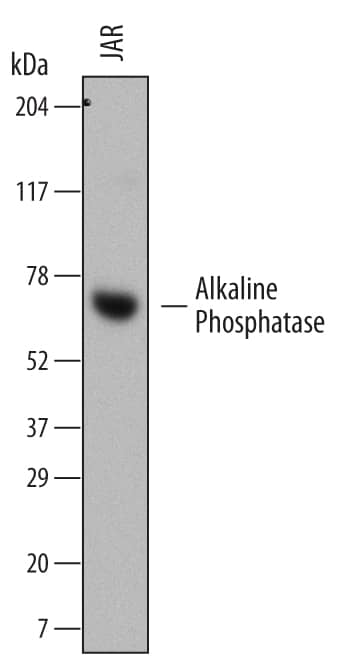 Detection of Human Alkaline Phosphatase/ALPP antibody by Western Blot.