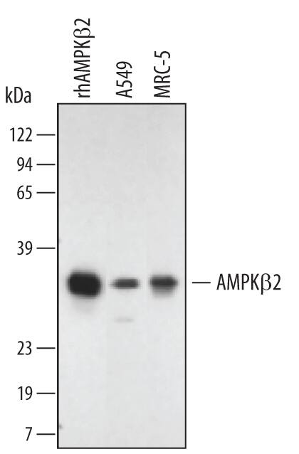 Detection of Human/Mouse AMPK beta2 antibody by Western Blot.