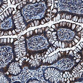 AMSH/STAMBP antibody in Human Colon by Immunohistochemistry (IHC-P).