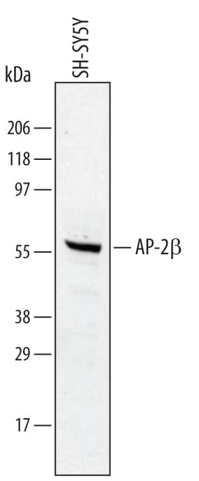 Detection of Human AP-2 beta antibody by Western Blot.