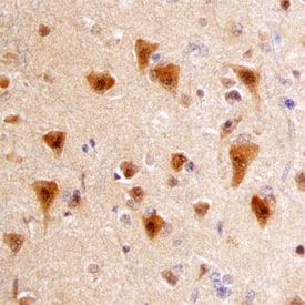 APH1A antibody in Human Brain by Immunohistochemistry (IHC-P).