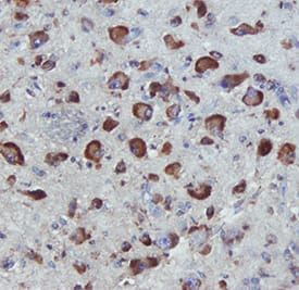 APJ antibody in Human Hypothalamus by Immunohistochemistry (IHC-P).