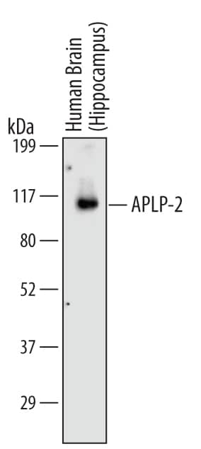 Detection of Human APLP-2 antibody by Western Blot.