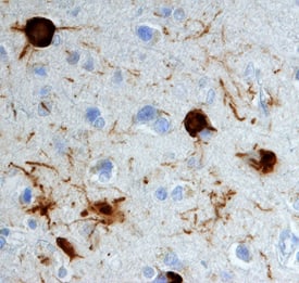 Phospho-APP/Protease Nexin II (T668) antibody in Human Brain by Immunohistochemistry (IHC-P).