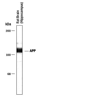 Detection of Amyloid Precursor Protein antibody by Western Blot.