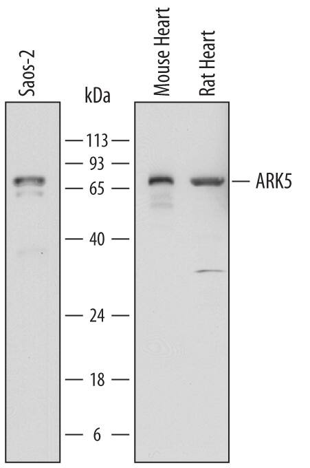 Detection of Human, Mouse, and Rat ARK5/NUAK1 antibody by Western Blot.