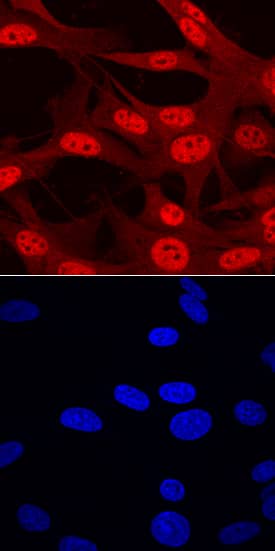 ARX antibody in U-87 MG Human Cell Line by Immunocytochemistry (ICC).
