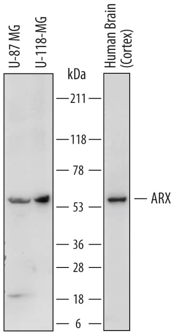 Detection of Human ARX antibody by Western Blot.