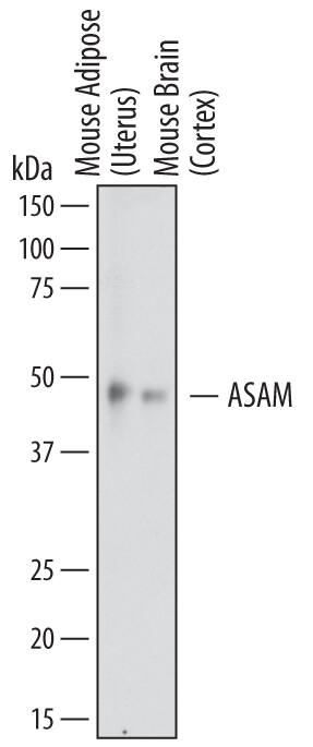 Detection of Mouse ASAM antibody by Western Blot.