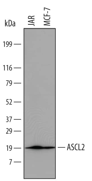 Detection of Human ASCL2/Mash2 antibody by Western Blot.