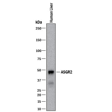 Detection of Human ASGR2 antibody by Western Blot.