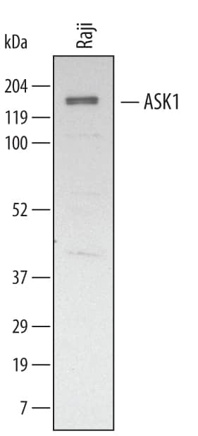 Detection of Human ASK1 antibody by Western Blot.