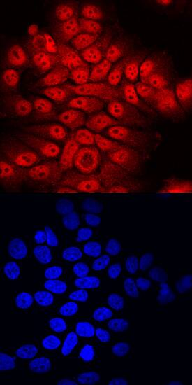 ATBF1/ZFHX3 antibody in MCF-7 Human Cell Line by Immunocytochemistry (ICC).