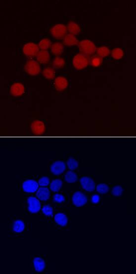 ATF4 antibody in Jurkat Human Cell Line by Immunocytochemistry (ICC).
