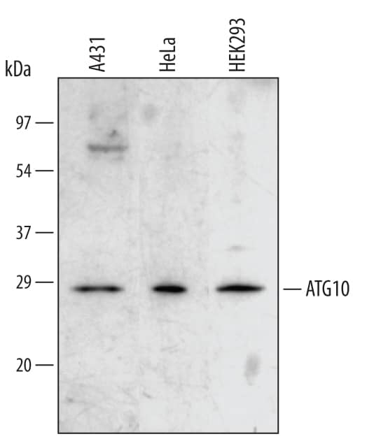 Detection of Human ATG10 antibody by Western Blot.