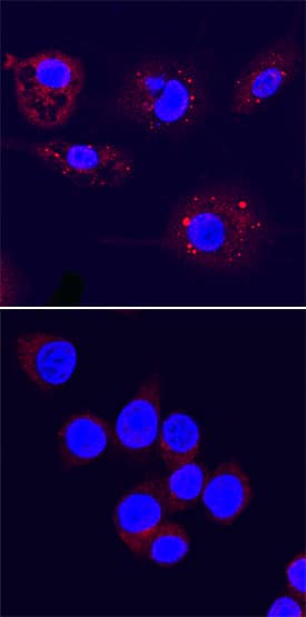 ATG3 antibody in RAW 264 by Immunocytochemistry (ICC).7 Mouse Cell Line by Immunocytochemistry (ICC).