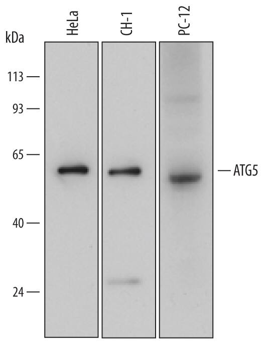 Detection of Human, Mouse, and Rat ATG5 antibody by Western Blot.