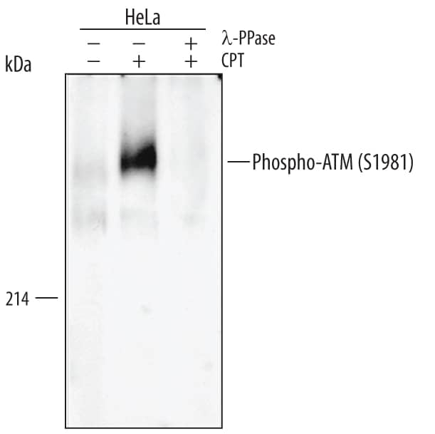 Detection of Human/Mouse/Rat Phospho-ATM (S1981) antibody by Western Blot.