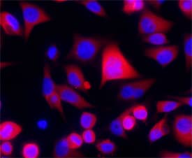 ATM antibody in HeLa Human Cell Line by Immunocytochemistry (ICC).