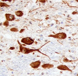 ATN1 antibody in Human Brain by Immunohistochemistry (IHC-P).