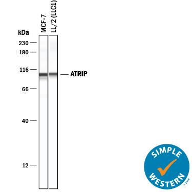 Detection of Human and Mouse ATRIP antibody by Simple WesternTM.