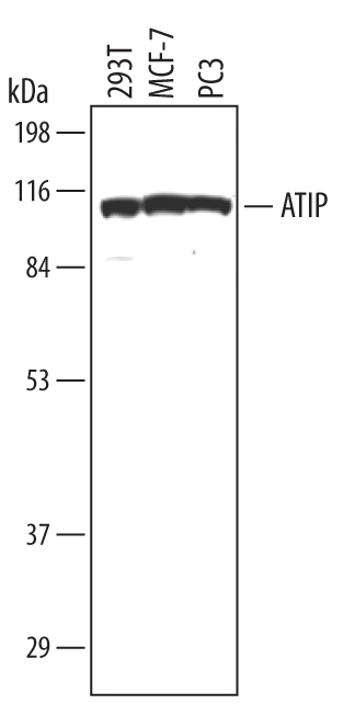 Detection of Human ATRIP antibody by Western Blot.