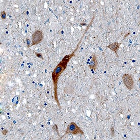 Acetylcholinesterase/ACHE antibody in Human Brain by Immunohistochemistry (IHC-P).