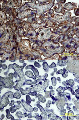 Activin RIA/ALK-2 antibody in Human Placenta by Immunohistochemistry (IHC-P).