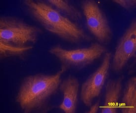 Activin RIA/ALK-2 antibody in HUVEC Human Cells by Immunocytochemistry (ICC).