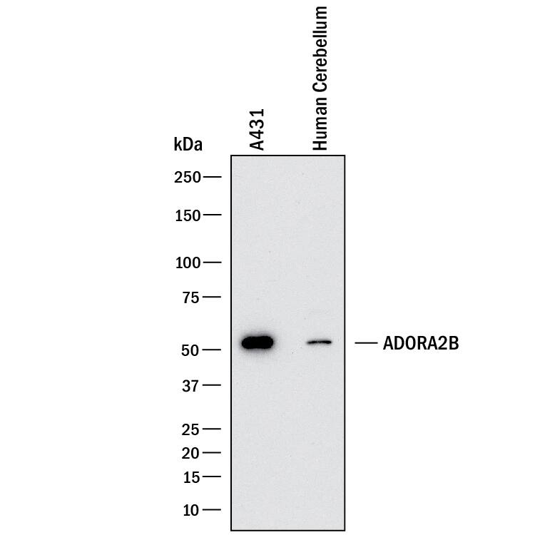 Detection of Human Adenosine A2b R antibody by Western Blot.