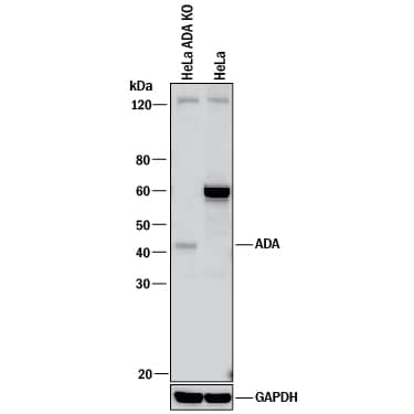 Western Blot Shows Human Adenosine Deaminase/ADA Antibody Specificity by Using Knockout Cell Line.