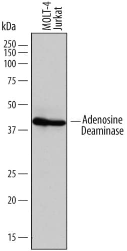 Detection of Human Adenosine Deaminase/ADA antibody by Western Blot.