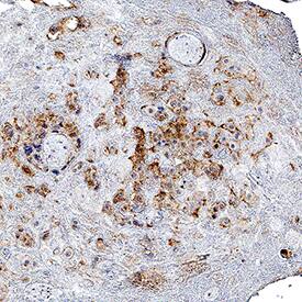 AdipoR1 antibody in Human Placenta by Immunohistochemistry (IHC-P).