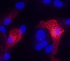 Adiponectin/Acrp30 antibody in human mesenchymal stem cells differentiated to adipocytes by Immunocytochemistry (ICC).