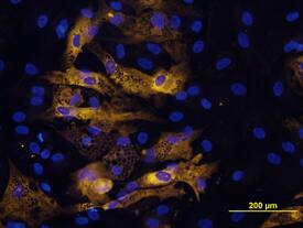Adiponectin/Acrp30 antibody in Mouse Adipocytes by Immunocytochemistry (ICC).