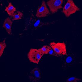 Adiponectin/Acrp30 antibody in Rat Adipocytes by Immunocytochemistry (ICC).