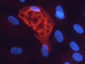 Adiponutrin/ADPN antibody in Human Adipocytes by Immunocytochemistry (ICC).