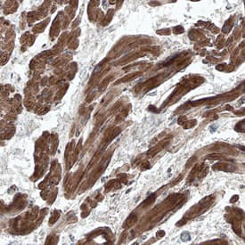 Adrenomedullin/ADM antibody in Human Heart by Immunohistochemistry (IHC-P).