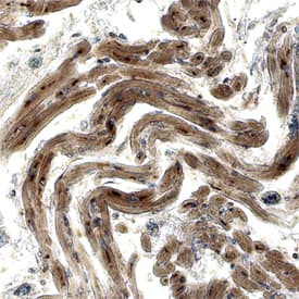 Adrenomedullin/ADM antibody in Human Heart by Immunohistochemistry (IHC-P).