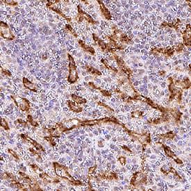 Adrenomedullin R/ADMR antibody in Human Spleen Tissue by Immunohistochemistry (IHC-P).