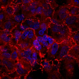 Afadin/AF-6 antibody in BEAS2B Human Cell Line by Immunocytochemistry (ICC).