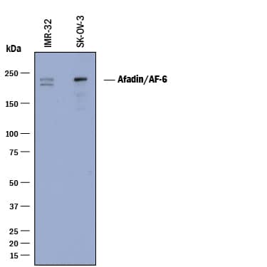 Detection of Human Afadin/AF-6 antibody by Western Blot.