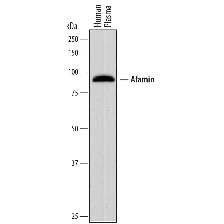 Detection of Human Afamin antibody by Western Blot.