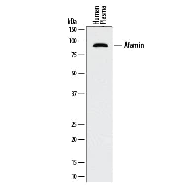 Detection of Human Afamin antibody by Western Blot.