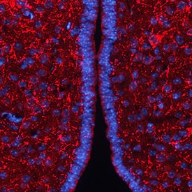 AgRP/ART antibody in Mouse Brain by Immunohistochemistry (IHC-Fr).