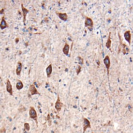 AgRP/ART antibody in Human Brain by Immunohistochemistry (IHC-P).