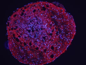 Aggrecan antibody in Rat Mesenchymal Stem Cells by Immunocytochemistry (ICC).