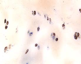 Aggrecan antibody in Human Cartilage by Immunohistochemistry (IHC-P).